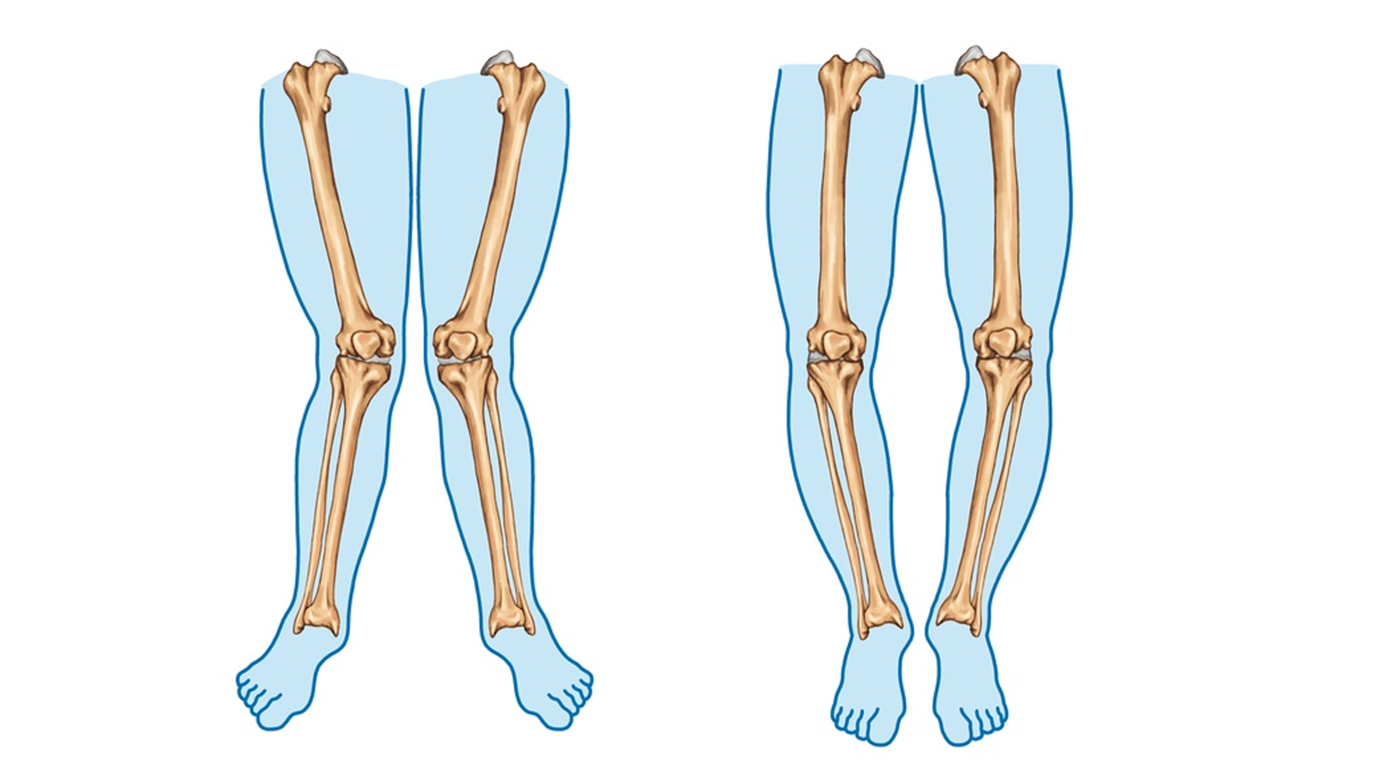 Arthroscopy